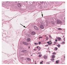 The second image is a micrograph of the innermost lining of the small intestine. This innermost lining is a simple columnar epithelium, with a single layer of rectangular cells oriented in a line. Occasionally, the line of epithelial cells is interrupted by a goblet cell. Goblet cells are thinner than the epithelial cells and appear roughly pill shaped. In this micrograph, the cells did not stain as darkly as the epithelial cells.