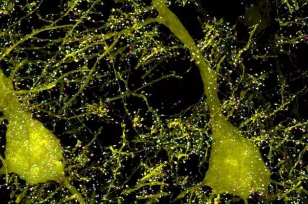 Description: This image, taken from a mouse brain, shows neurons (yellow) and proteins involved in their synapses (cyan and magenta).