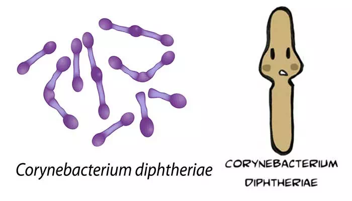 Laboratory diagnosis, treatment and prevention of Corynebacterium diphtheriae